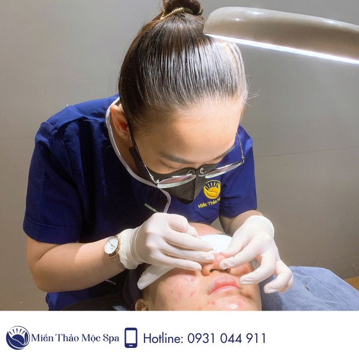 Quy trình chuẩn chăm sóc cho da sau nặn mụn