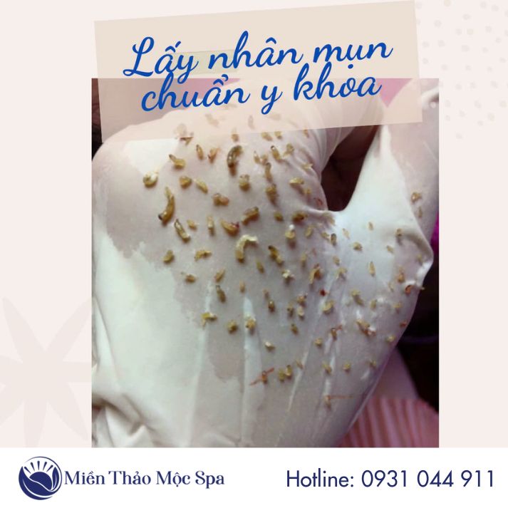 lay-nhan-mun-chuan-y-khoa