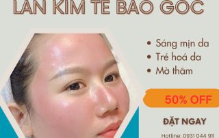 Ưu đãi sốc giảm 50% dịch vụ liệu trình lăn kim trẻ hoá da