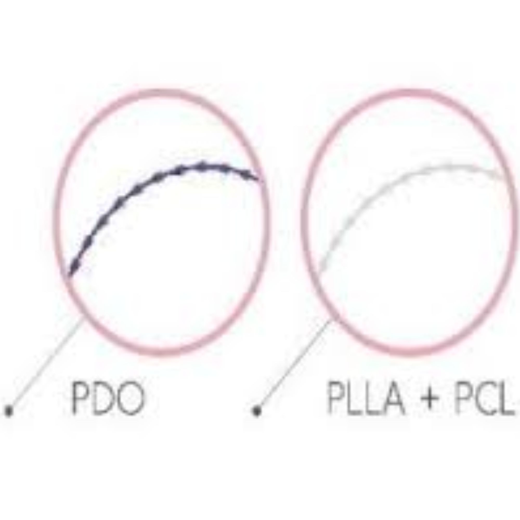 Căng Chỉ PDO Và PCL Khác Nhau Như Thế Nào?