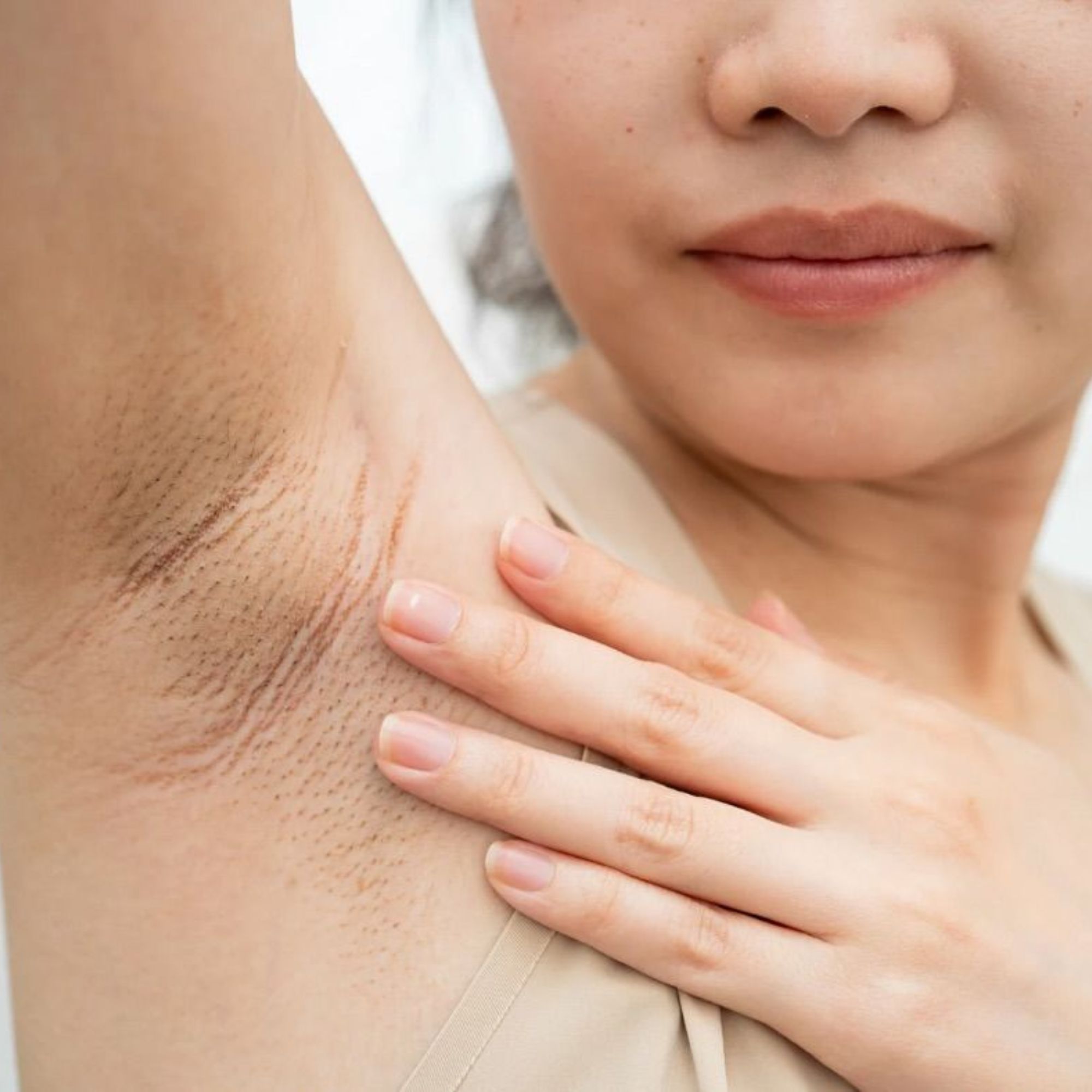 Cạo Lông Nách Có Làm Lông Mọc Rậm Hơn Không?