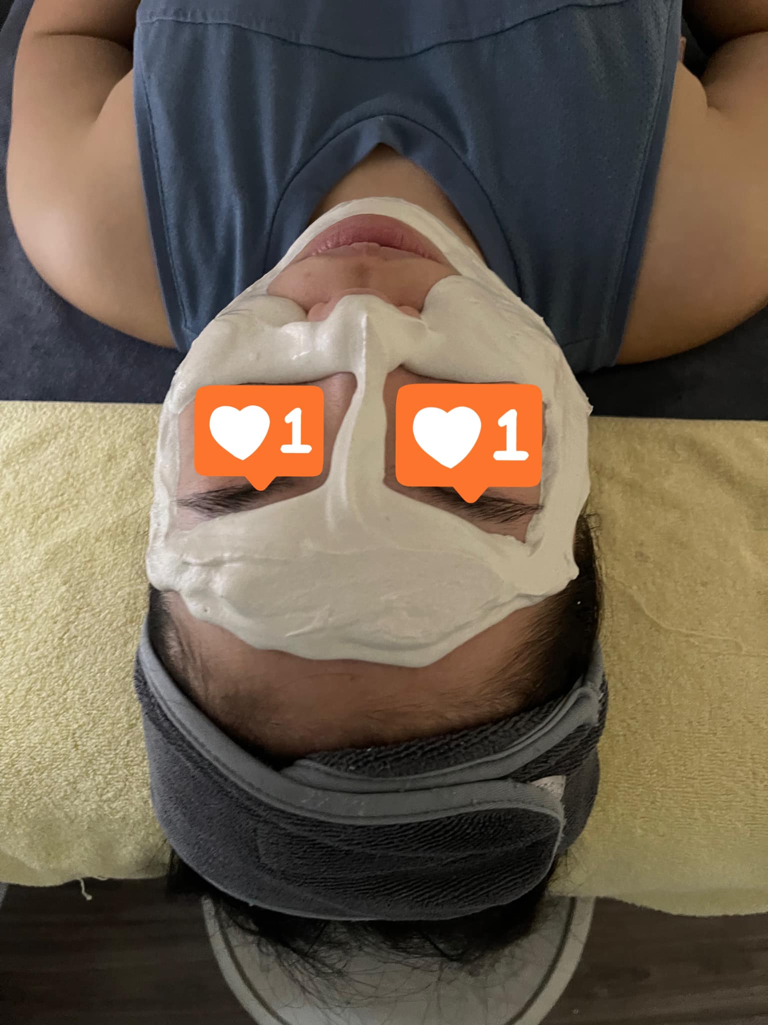 Lấy Nhân Mụn Chuẩn Y Khoa Là Gì