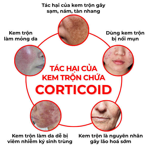 Phục hồi làn da nhiễm Corticoid 2 Phuc hoi lan da nhiem Corticoid 2