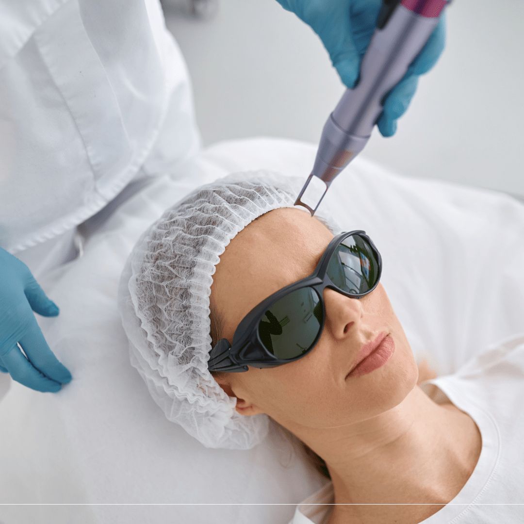 So Sánh Laser Pico Và Laser Fractional CO2