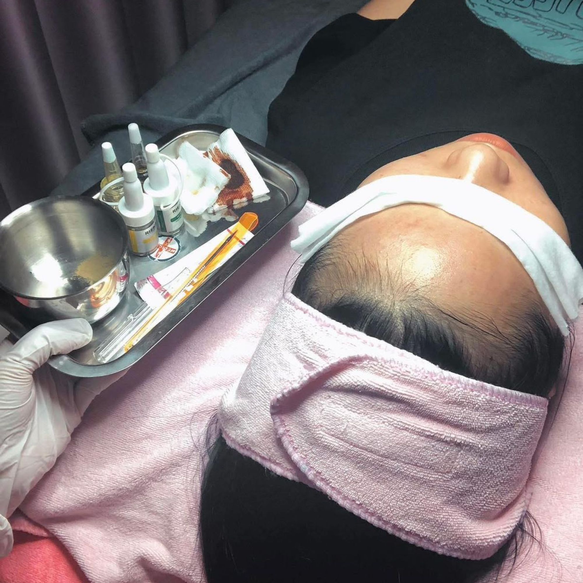 Trị mụn bằng thuốc hay spa tốt hơn? Phác đồ dứt điểm từ chuyên gia