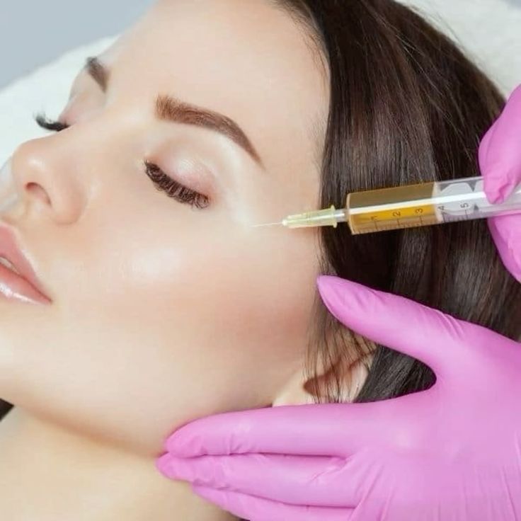 Vì Sao Nhiều Người Phải Tan Filler Sau Khi Tiêm