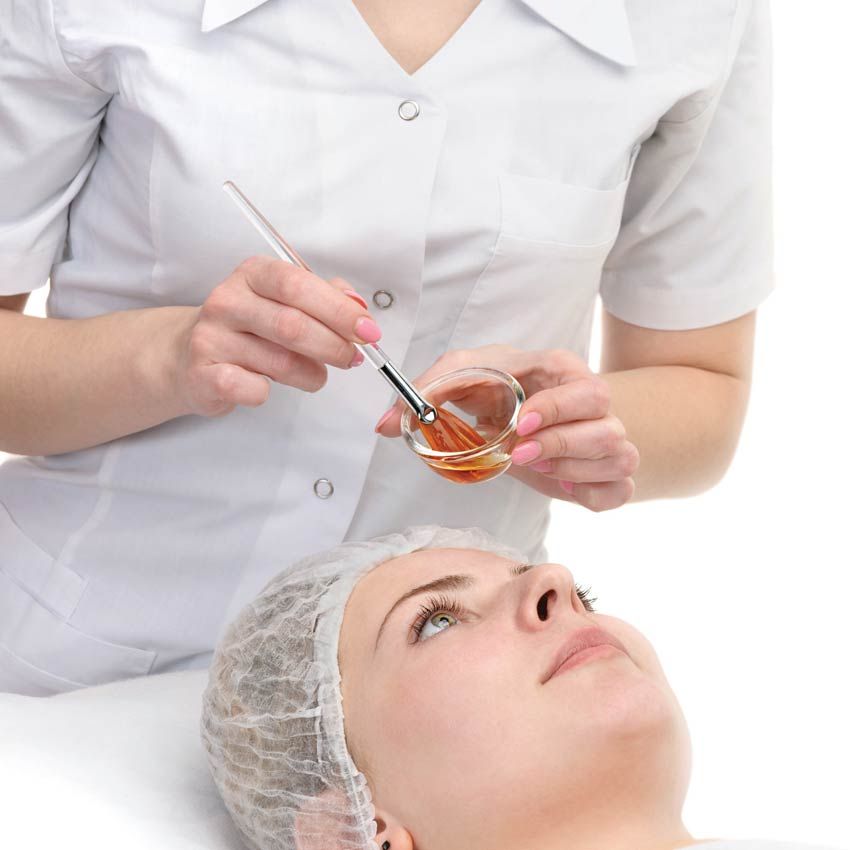 Vì Sao Peel Da Mà Mụn Viêm Lại Nặng Hơn