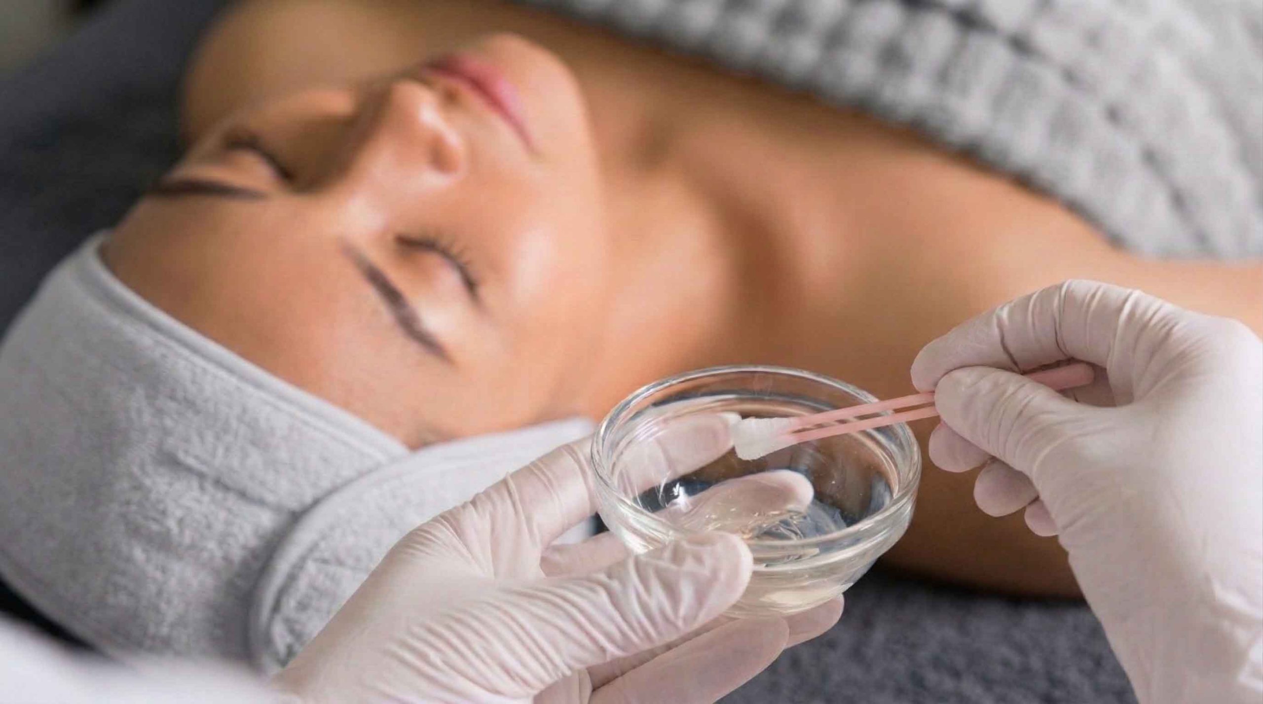 Peel da loại bỏ mụn ẩn, mụn viêm 2 Peel-da-loai-bo-mun-an-mun-viem-2