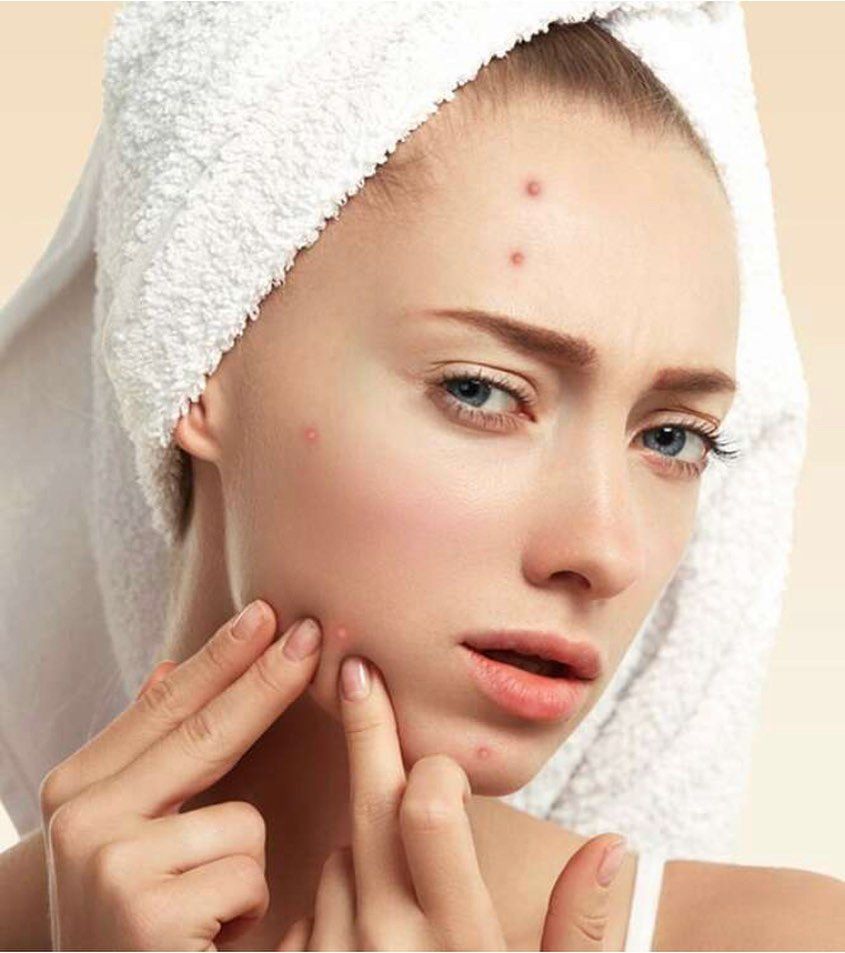 Tại Sao Da Đang Đẹp Lại Nổi Mụn Nhiều