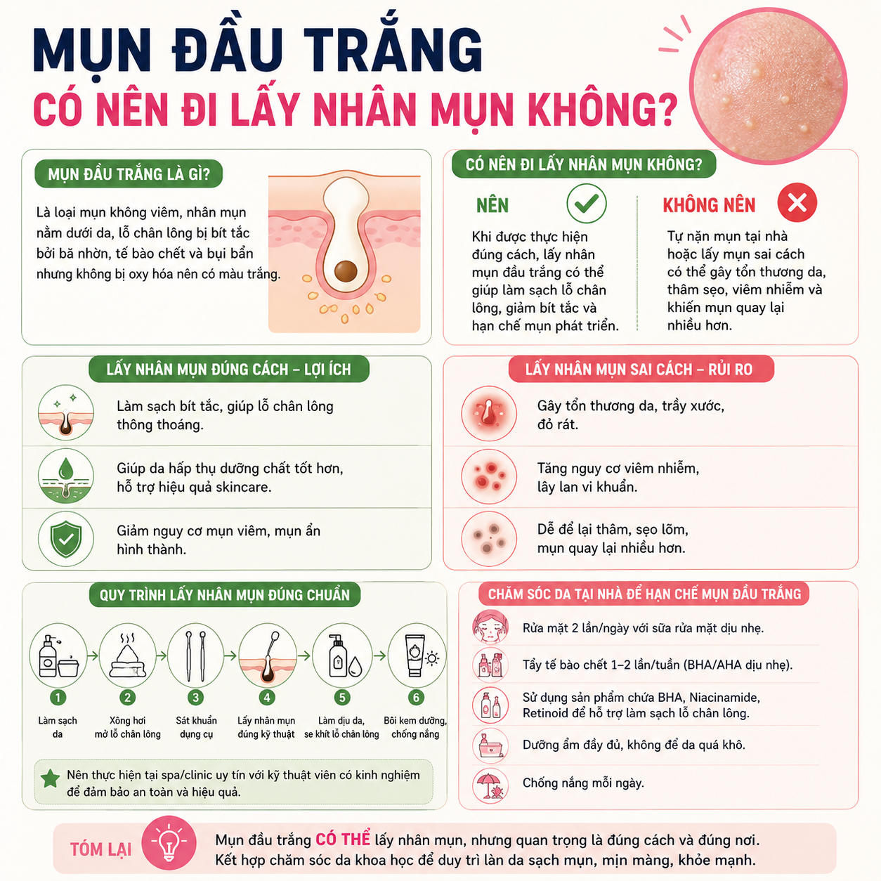 Mụn Đầu Trắng Có Nên Đi Lấy Nhân Mụn Không?