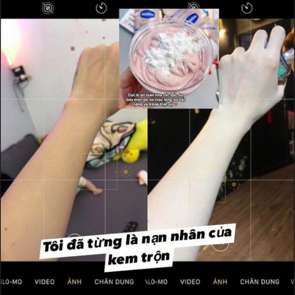 Corticoid Thường Xuất Hiện Trong Những Loại Mỹ Phẩm Nào