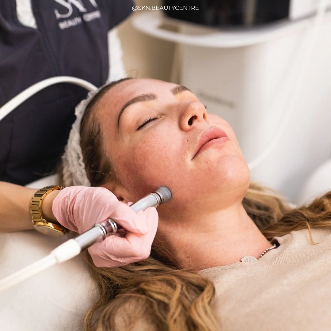 Điều Trị Da Nhiễm Corticoid Giá Bao Nhiêu