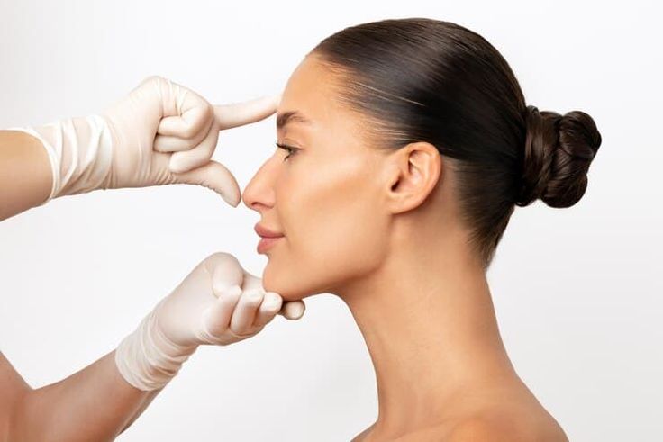 Tiêm Filler Mũi Là Gì. Vì Sao Nhiều Chuyên Gia Khuyên Không Nên Tiêm